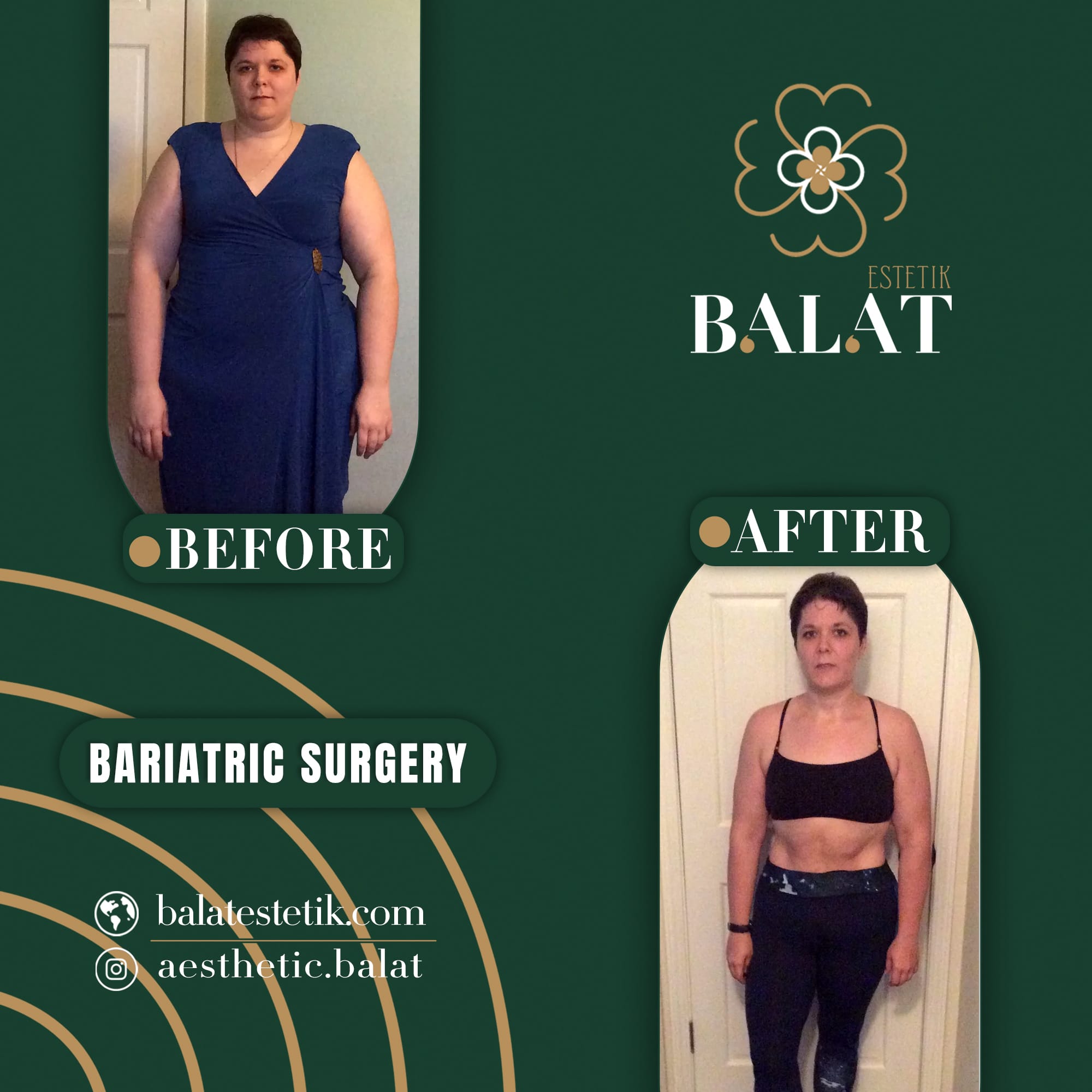 Bariatric 3